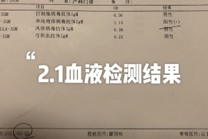 「北京海淀出现1例初筛阳性」〃北京海淀新增1例本土确诊