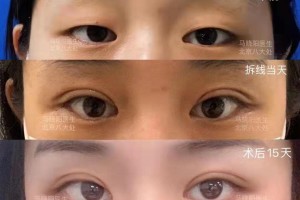 【合肥美的确诊病例/合肥美的死人】