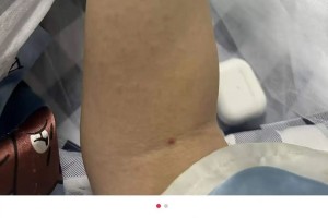 “31个省份新增确诊病例17例” 31个省新增确诊病例30例？