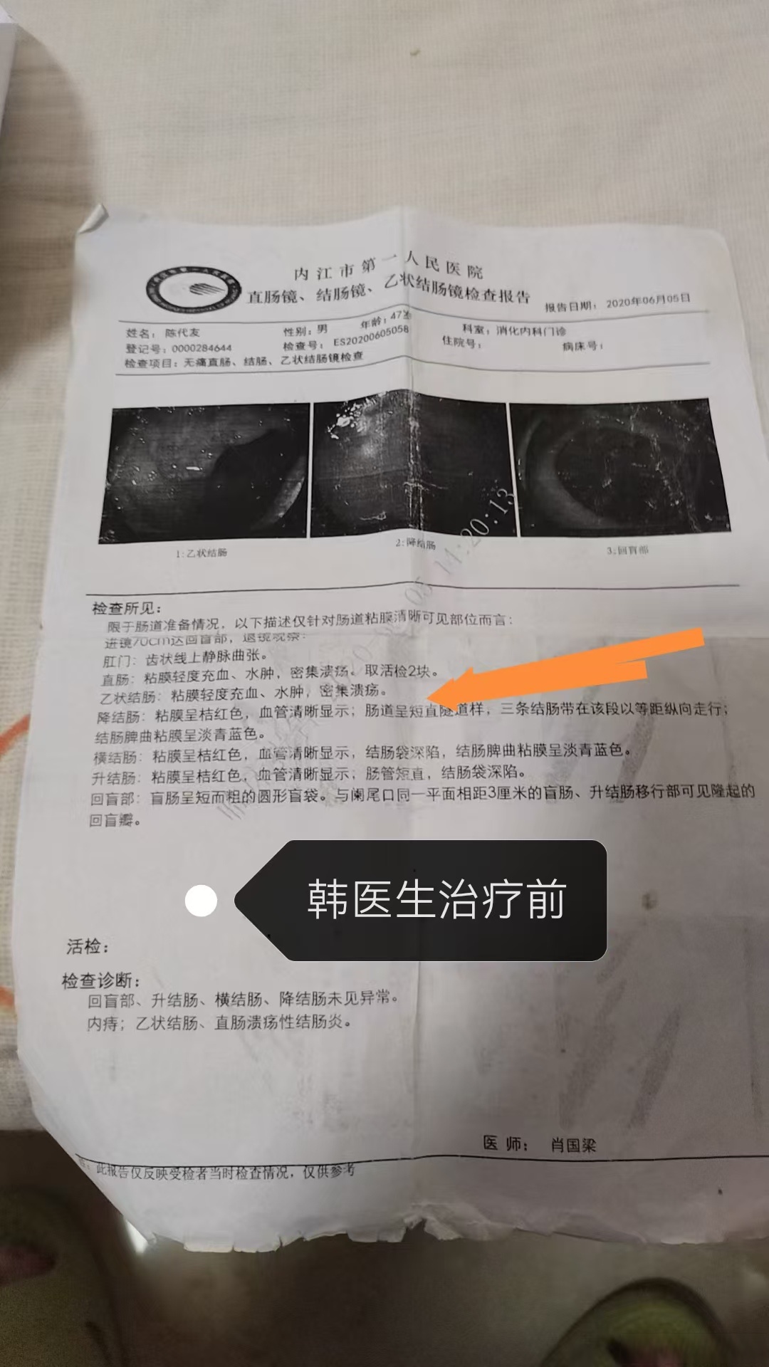 贵州新增确诊病例1例-贵州新增1例疑似病例-第3张图片