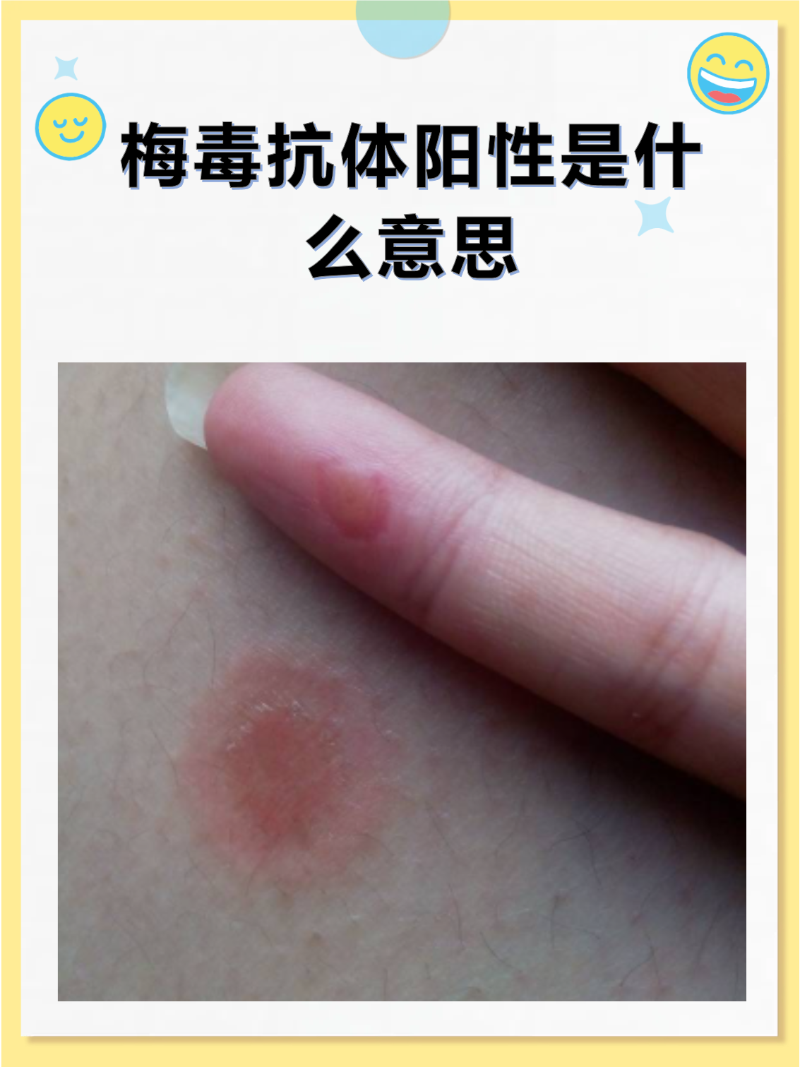 南京新增无症状感染者抗体阳性︰(南京新增一例无症状感染者抗体阳性)-第1张图片