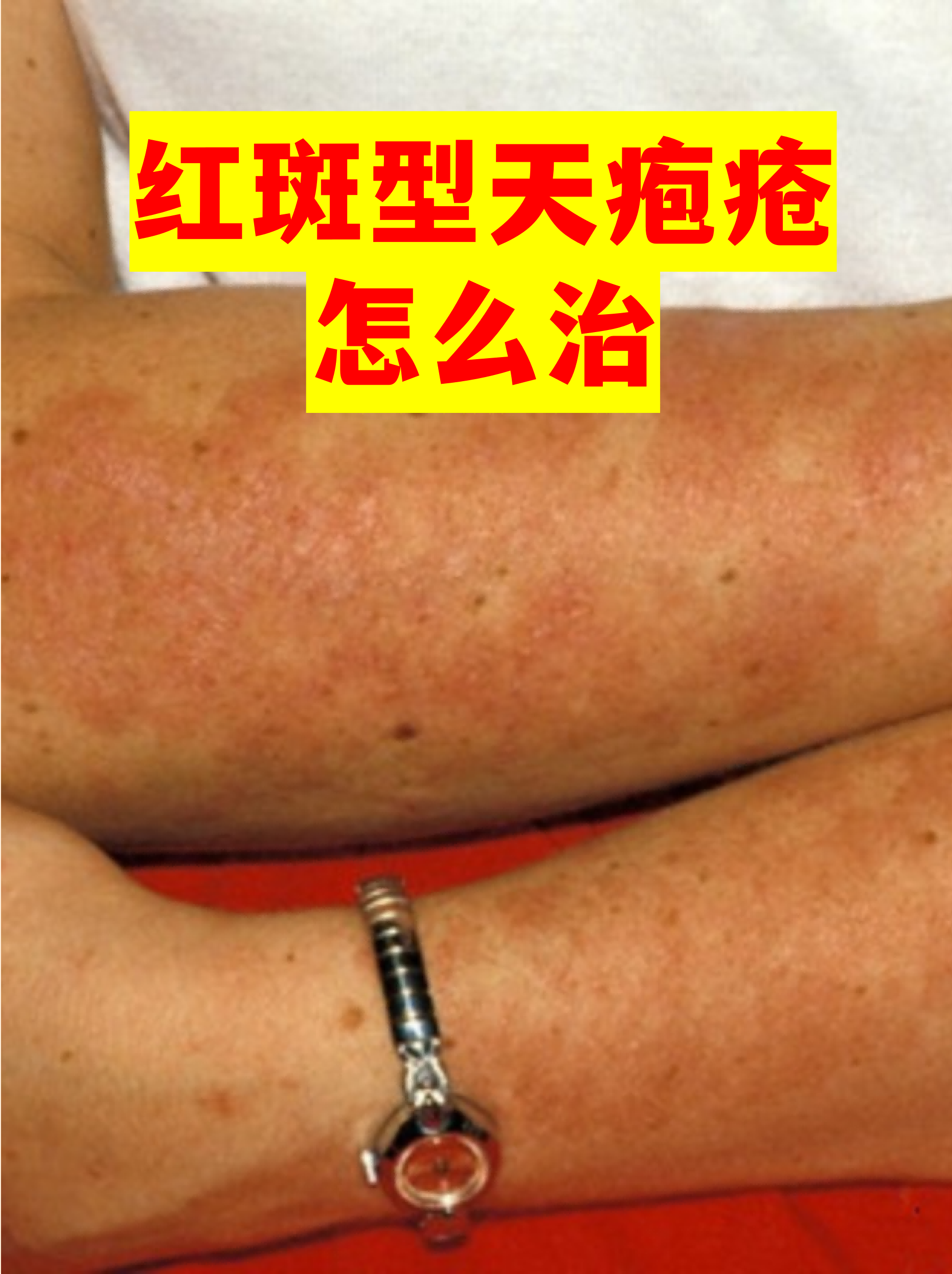 “四川新增省内感染者30例	” 四川新增感染者的症状？-第1张图片