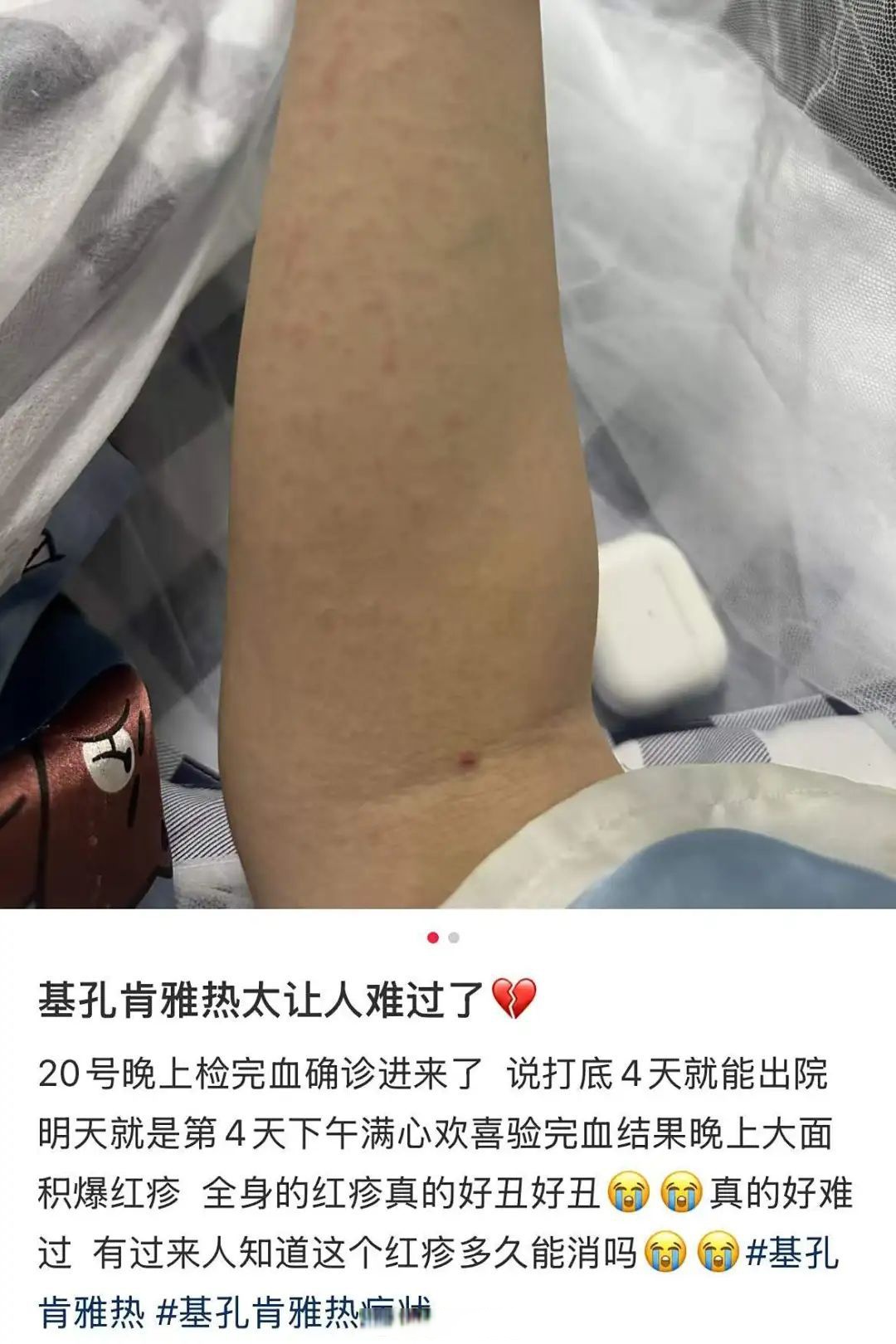 “31个省份新增确诊病例17例” 31个省新增确诊病例30例？-第1张图片