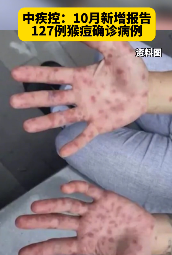 “湖北新增本土无症状11例” 湖北新增无症状感染者15例？-第1张图片