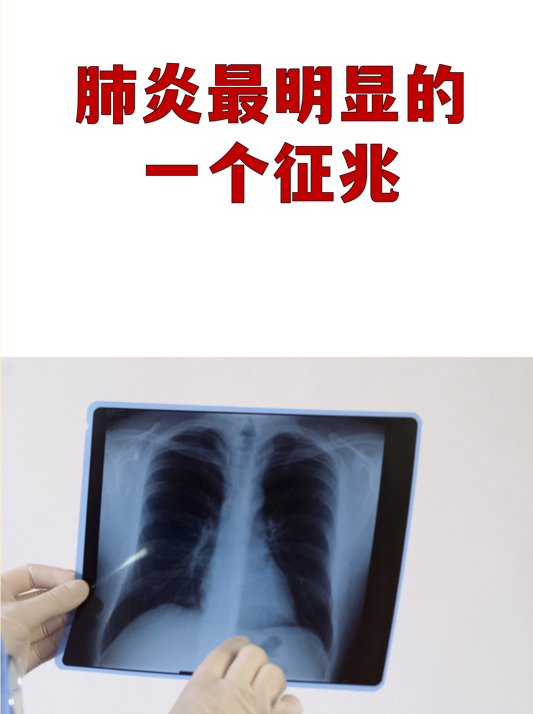 黑龙江新增28例确诊8例无症状〃黑龙江新增27例确诊 新增43例无症状-第2张图片